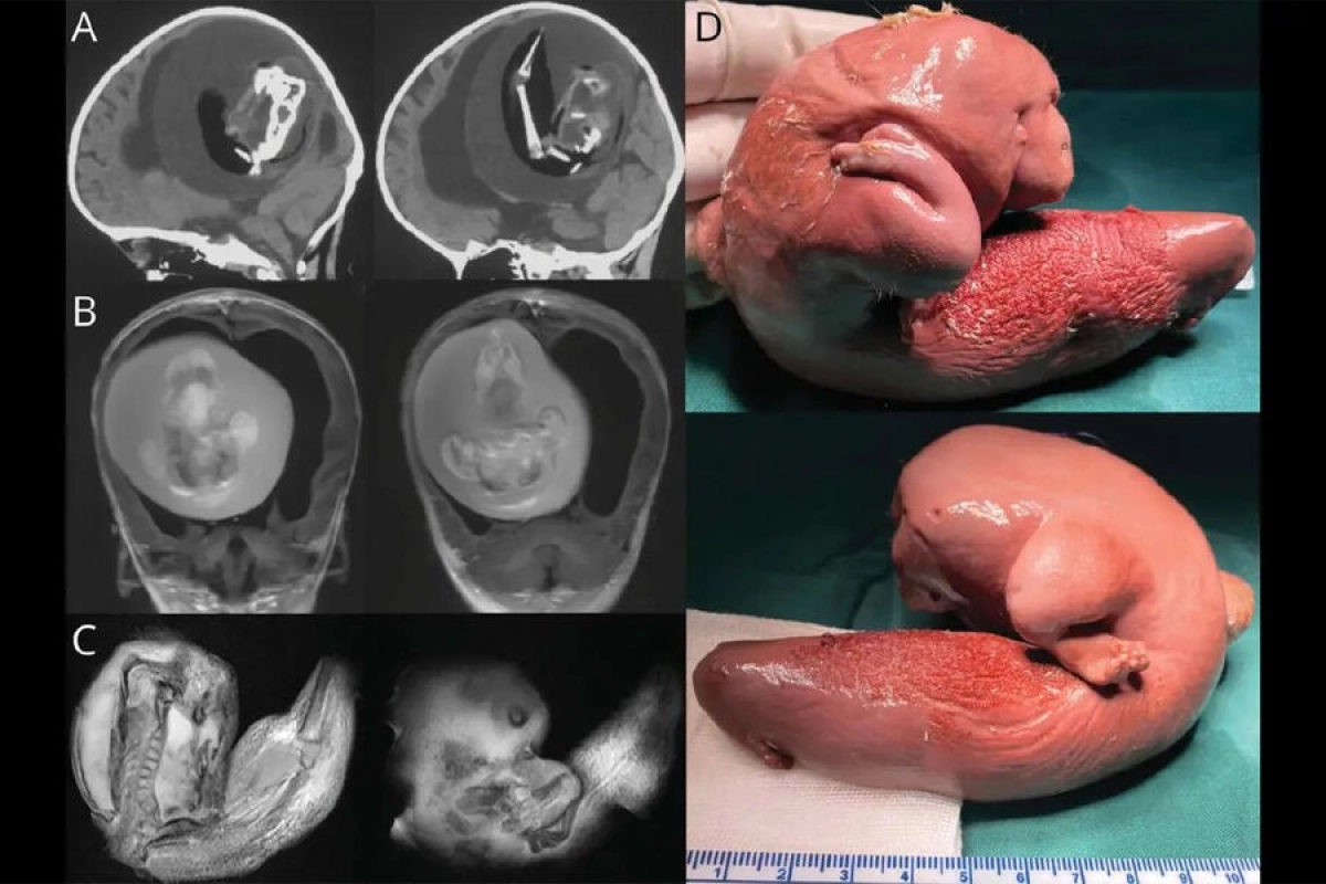 Фото: Wolters Kluwer Health, Inc