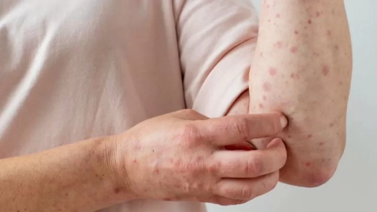 Фото: renewal.ru