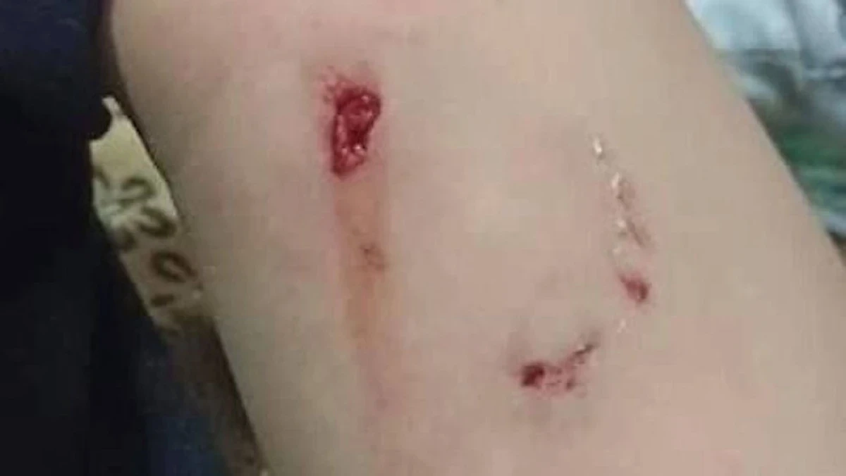 Фото: instagram.com/ablaketka_novosti