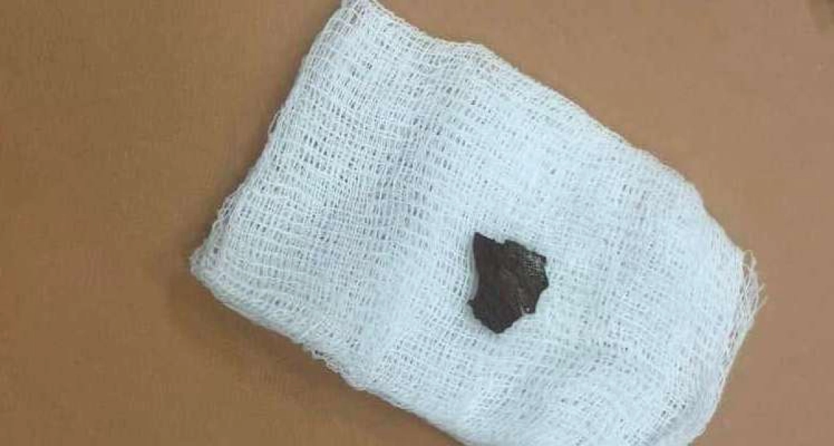 Фото: пресс-служба управления здравоохранения Мангистауской области