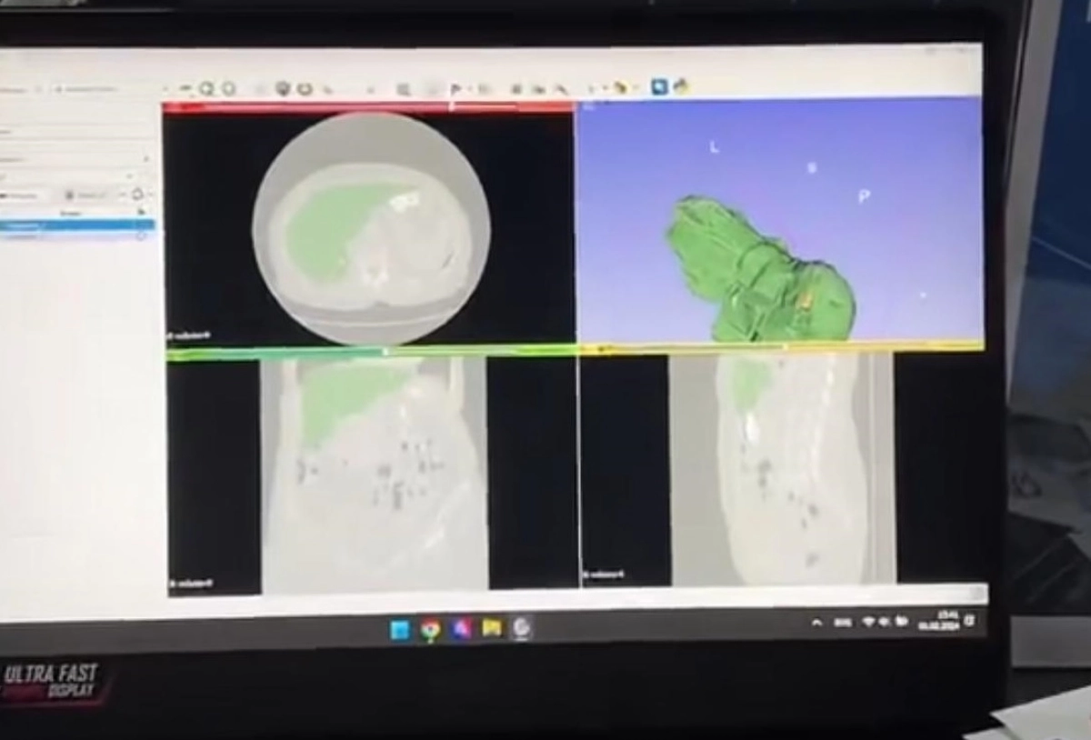 Фото: скриншот из видео