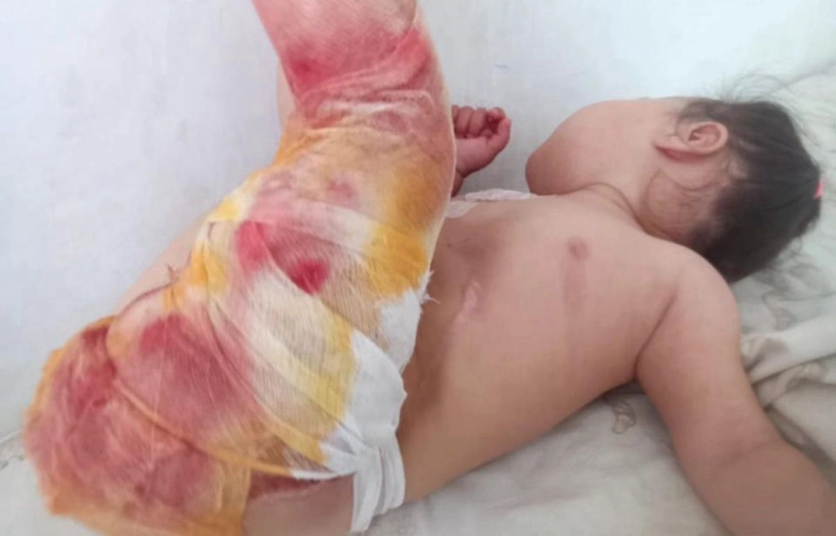 Фото: из личного архива Айнур