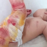 Шокирующий случай в Кызылорде. Воспитатели обварили ребенка