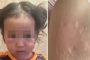 «Невозможно выйти на улицу»: жители Атырау жалуются на комаров