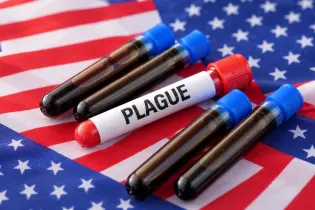 Посольство США выпустило предупреждение из-за угрозы легочной чумы в России