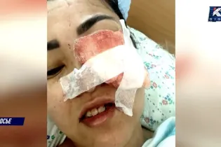 «Я не смогу иметь детей»: казахстанка заявила о тяжелых последствиях лечения зубов