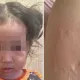 «Невозможно выйти на улицу»: жители Атырау жалуются на комаров