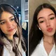 «Надежда на чудо»: девушка, на которую упало дерево в роще Баума, все еще в коме