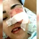 «Я не смогу иметь детей»: казахстанка заявила о тяжелых последствиях лечения зубов